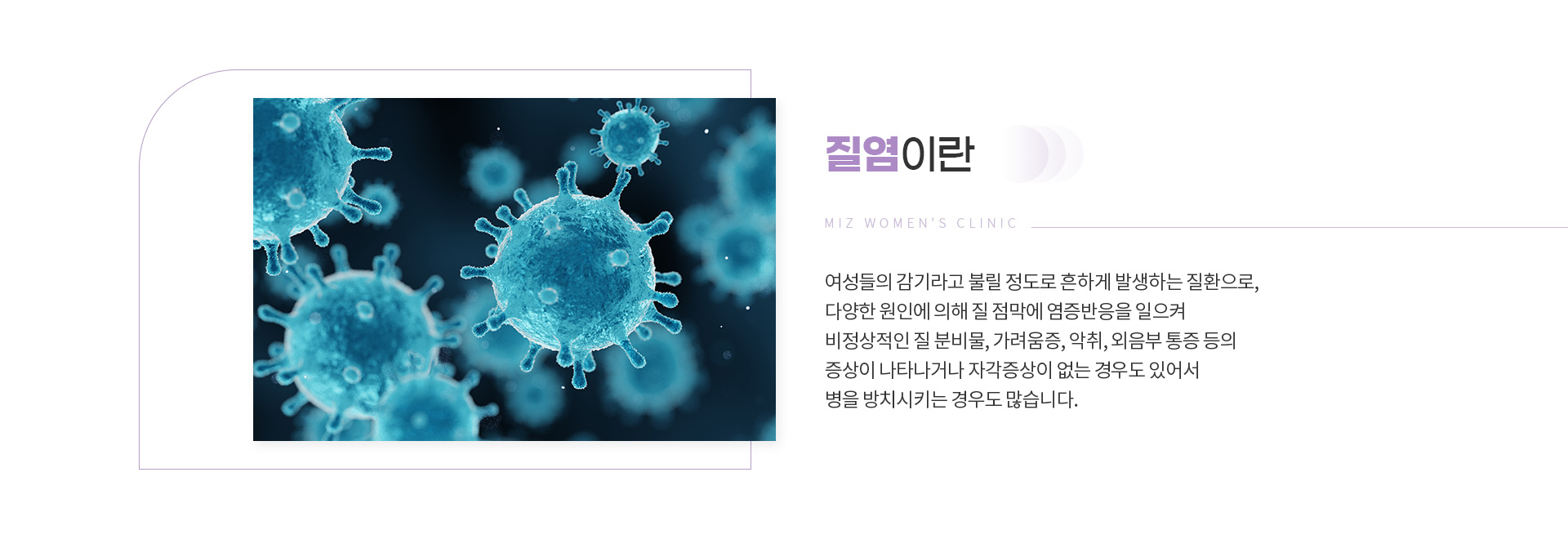 질염 02