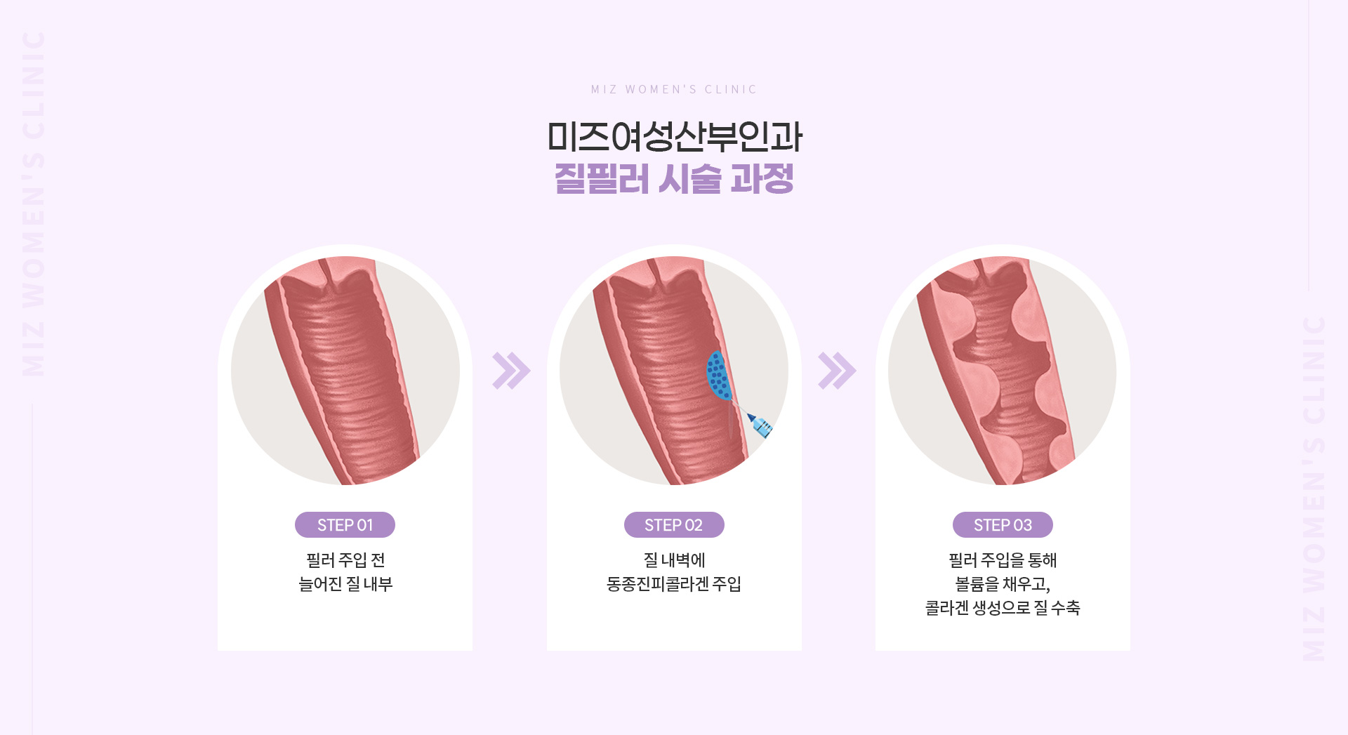 질필러 04