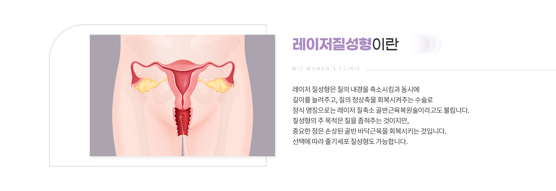레이저질성형 02