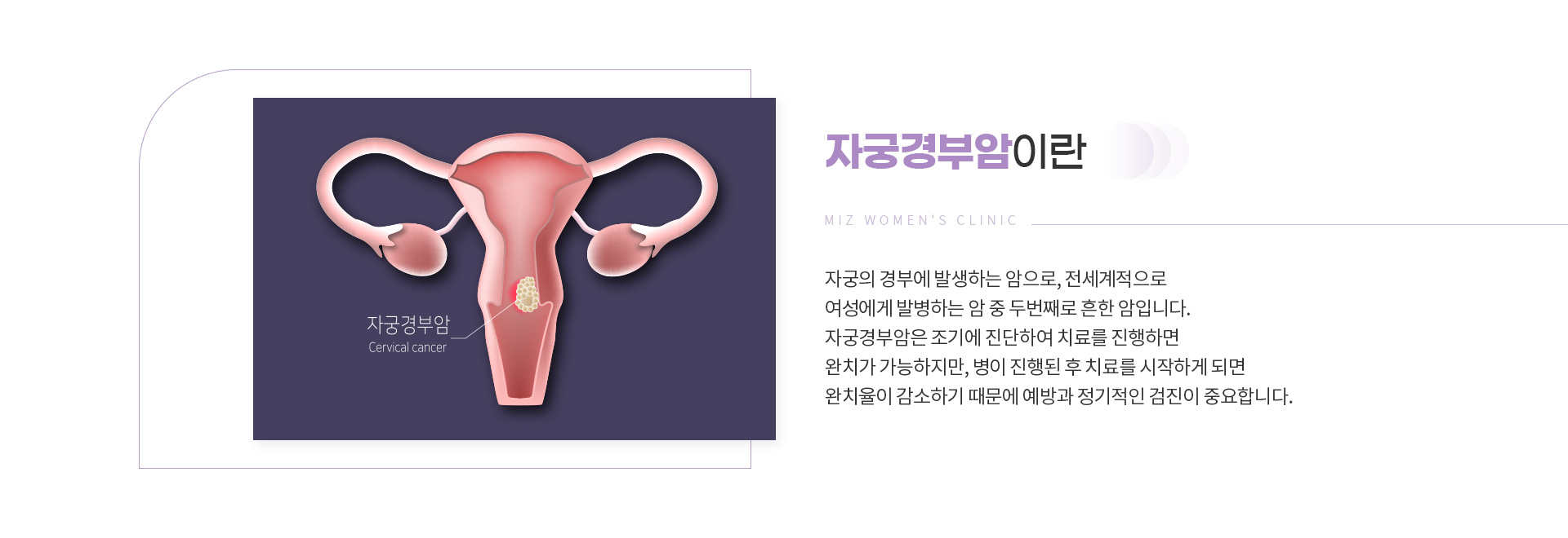 암검진 04
