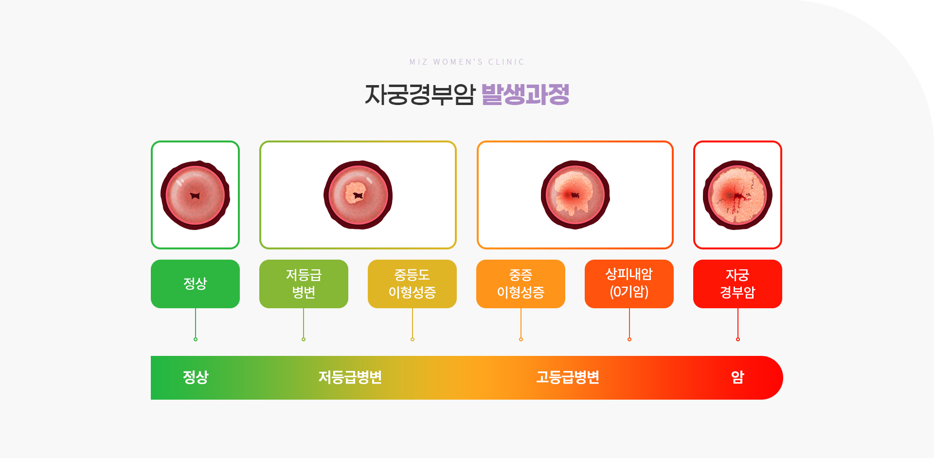 암검진 05
