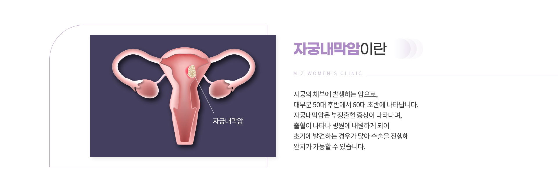 암검진 09