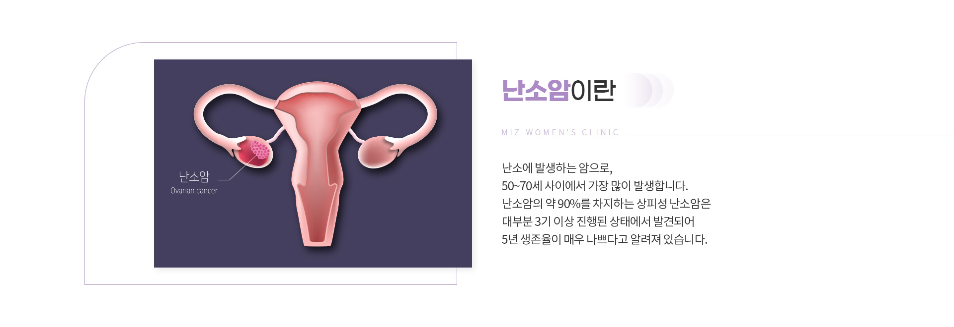 암검진 12